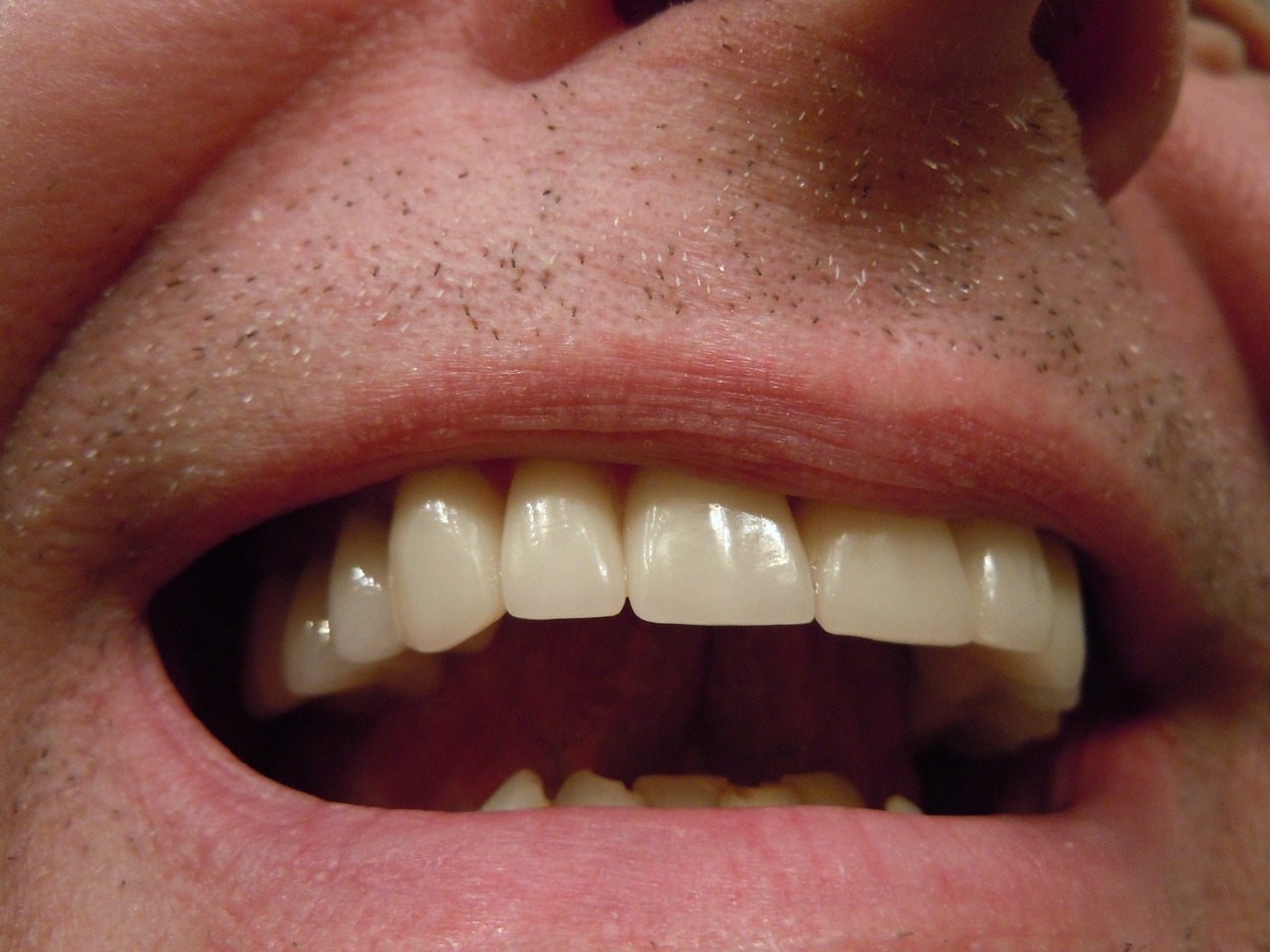 Benefits of Dental Crowns