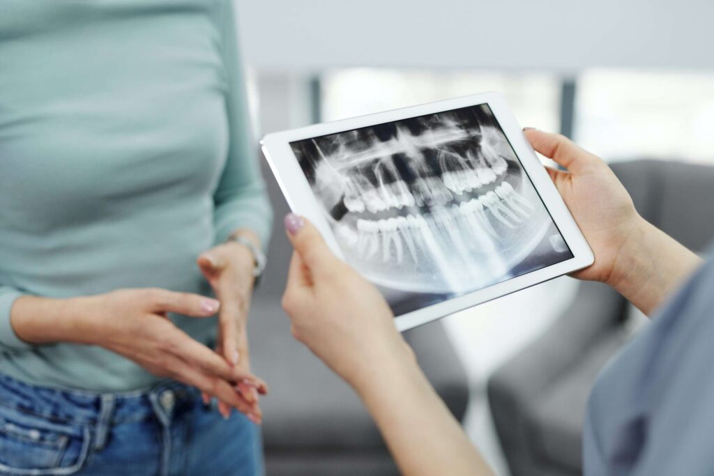The Benefits and Risks of Bone Grafting for Dental Implants