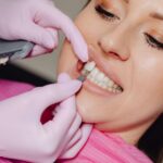 The Benefits of Porcelain Veneers for Your Oral Health